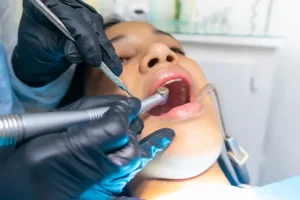 What You Need To Know About Removing Wisdom Teeth: The Pros & Cons